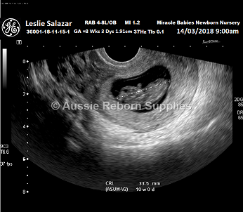 Fake 8 Week Ultrasound Scan Personalized