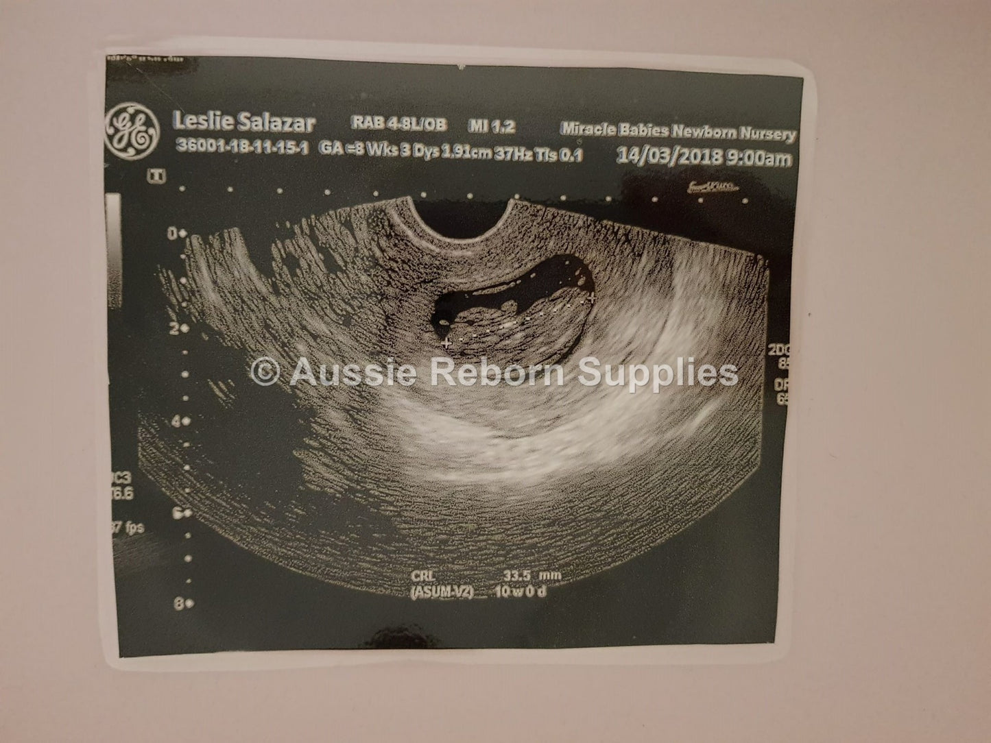 Fake 8 Week Ultrasound Scan Personalized